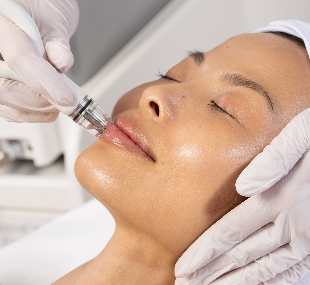 asian woman recieving diamond glow treatment on face