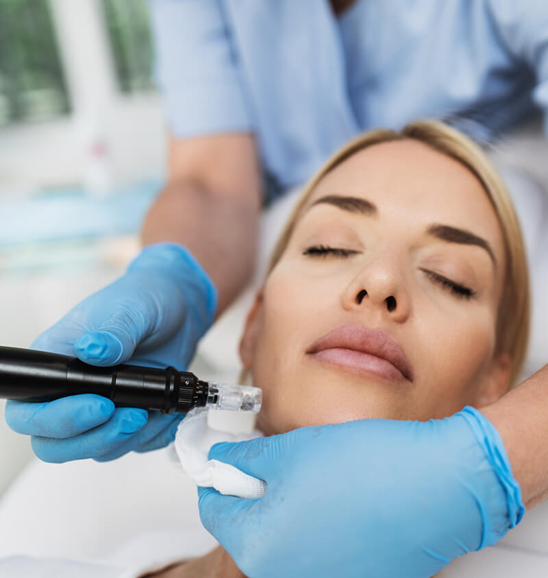 Microneedling In NYC