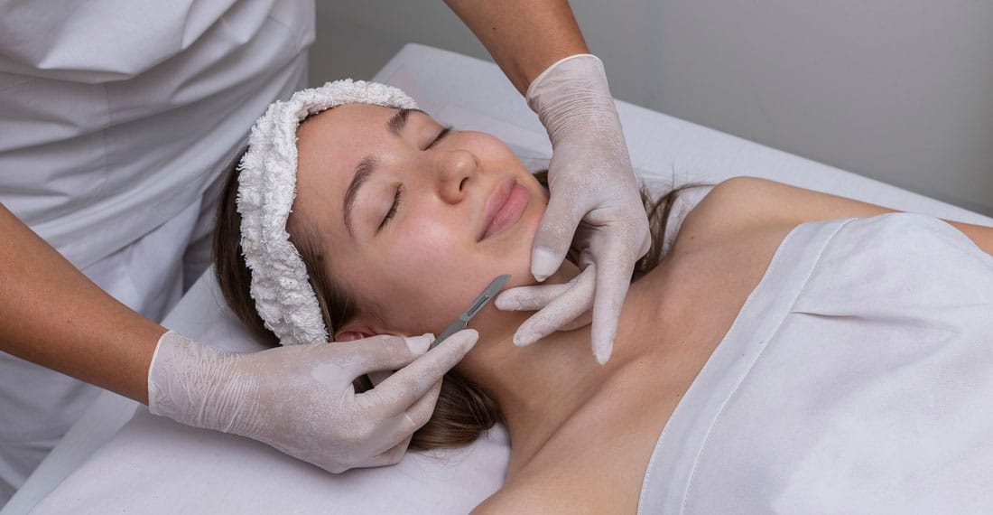 young woman lying on a stretcher in an aesthetic center performing beauty treatment and facial aesthetics with dermapen and dermaplaning techniques young woman lying on a stretcher in an aesthetic center performing beauty treatment and facial aesthetics with dermapen and dermaplaning techniques